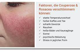 Rosacea, or acne rosacea, has been defined as vascular and follicular dilation involving the nose and contiguous portions of the cheeks. Couperose Rosacea I Rotungen Reduzieren Richtig Ernahren