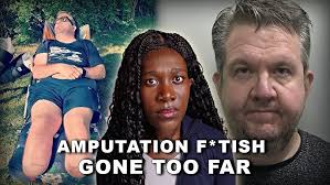 9.15 Pediatric Surgeon