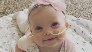 3.21.19 Salina Downsyndrome pkg corrected