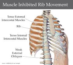The rib cage is an origin and insertion area for many muscles. Mal Aligned Rib Cage A Case Study