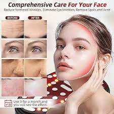 Amazon.com: Microcurrent Multifunctional Facial Device, FSA HSA Eligible  Smart Photon Micro-Current Device Electric Face Lift Light Therapy Skin  Care Beauty Machine : Beauty & Personal Care