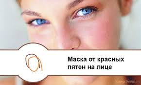 как избавиться от белых пятен на лице в домашних условиях Maska Ot Krasnyh Pyaten Na Lice Lico Maski Telo
