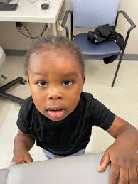 What are some natural mosquito repellents and remedies for allergic  reactions to mosquito bites?