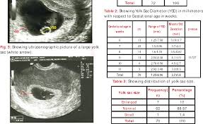 table 3 from size of yolk sac by ultrasonography and its