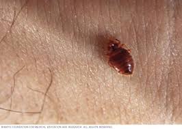 Look for a series of bites that appear in a line or a random grouping of bites. Bedbugs Symptoms And Causes Mayo Clinic