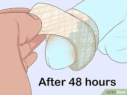 In time, the redness will subside, and the swelling will reduce as healing progresses. How To Clean A Circumcision 15 Steps With Pictures Wikihow Mom