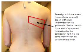 Image result for Murphy Sign