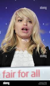 Katie piper acid hi-res stock photography and images