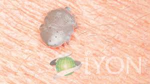 uyuz bocegi ilaclama iyon bocek ilaclama hasere mucadele