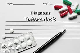 © world health organization 2017 some rights reserved. Monitoring Tuberculosis Treatment By Video Might Convenience Increase Compliance Hospital News