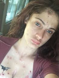 If you are doing the Recovery Thing and you think no one cares. We here at  Project WisHope Sauk County Do and are proud of you! Keep Going! We Do  Recover.💜