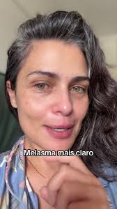 Melasma mais claro: Dicas de cuidados para a pele