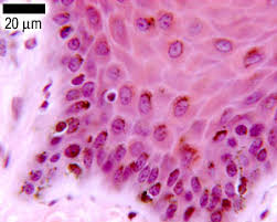 Image result for Melanocyte