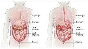 Crohn S Disease Children S Hospital Of Philadelphia