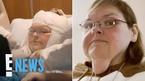 Tammy Slaton Reveals Skin Removal Surgery Results