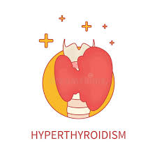 Hypothyroidism and hyperthyroidism