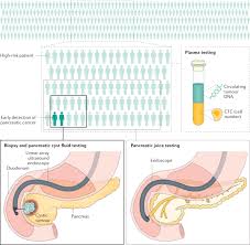 Tests and procedures to stage pancreatic cancer are usually done at the same time as diagnosis. Early Detection Of Pancreatic Cancer Using Dna Based Molecular Approaches Nature Reviews Gastroenterology Hepatology