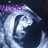 This week a very important control center, the hypothalamus, begins to form. Https Encrypted Tbn0 Gstatic Com Images Q Tbn And9gcsq6l6pjbldthnjn06ve2auws0xcxjrdrokhnujrib2oxc8 Cqq Usqp Cau