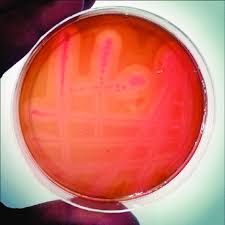 We did not find results for: Double Zone Of Hemolysis Produced By Clostridium Perfringens On Sheep Download Scientific Diagram