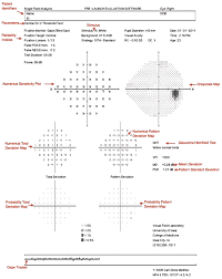 Visual Field Testing From One Medical Student To Another