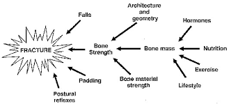 pathophysiology of osteoporosis sciencedirect