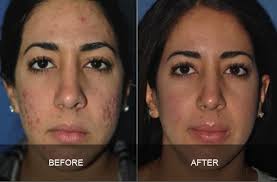 It is skin specific and you really need to know which zo skin care products you will need. Zo Skin Health And Facials Newport Beach Dr Kosins Cosmetic Plastic Surgery And Dermatology