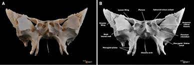 It makes up most of the middle part of the base of the skull and contributes to the floor of the middle cranial fossa of the skull. Photography Anterior View Of The Sphenoid Bone This Anterior View Download Scientific Diagram