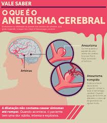 Office of communications and public liaison national institute of neurological disorders and. Aneurisma Cerebral O Que E Quais Os Sintomas Hcor