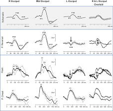نتیجه جستجوی لغت [reversal] در گوگل