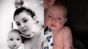 The skin of your baby can become mottled or pale blue color in cold weather. Covid 19 Baby S Mother Issues Mottled Skin Warning Bbc News