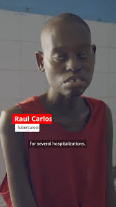 Mozambique is a country that grapples with a dual epidemic of HIV and  Tuberculosis (TB), including drug-resistant TB, with high infection rates  among vulnerable and stigmatised groups. , Today, we ...