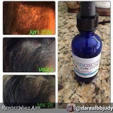 Kaleidoscope extra strength miracle drops hair growth oil 2 oz. Facebook