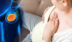 But how do you know if you've got the disease? I Also Suffered From Breast Cancer But If It Happens To My Daughter Worried About The Transmission Of Breast Cancer Newsdir3