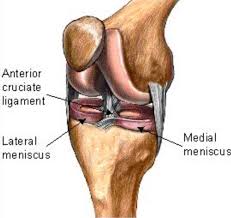 The Medial Collateral Ligament Mcl Is On The Inner Of The Leg And Supports The Knee Simi Cruciate Ligament Anterior Cruciate Ligament Reconstructive Surgery
