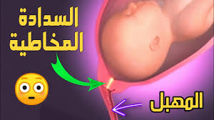 السدادة المخاطية تعني بالضبط ما يرمز إليه الإسم، سدادة مكونة من المخاط. Ø§Ù„Ø³Ø¯Ø§Ø¯Ø© Ø§Ù„Ù…Ø®Ø§Ø·ÙŠØ© ÙÙŠ Ø§Ù„Ø±Ø­Ù… Ù…Ø´Ø§Ù‡Ø¯ Ù…Ø°Ù‡Ù„Ø© ØªØ¹Ø±Ø¶ Ù„Ø£ÙˆÙ„ Ù…Ø±Ø© Youtube