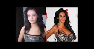 Si l'amie de maeva ghennam et de manon tanti ne cuisine pas, c'est parce qu'elle ne sait pas le faire, selon ses dires. Nabilla Benattia Meconnaissable Avant La Chirurgie Purepeople