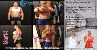 Pin On How To Lose Weight