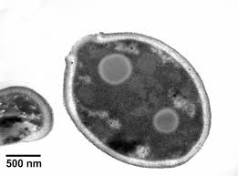 Image result for Cremaspora triflora