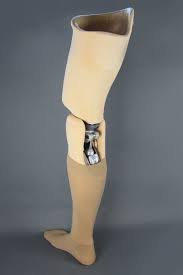 Eine Oberschenkel Prothese Mit Dem Von Einem Mikroprozessor Gesteuerten Kniegelenk Cleg Prothese Prothetik Schenkel Oberschenkel