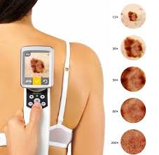 Although the percentage of cases in men is much lower than in women, male breast cancer accounts for a por. Bondi Junction Skin Cancer Clinic In Sydney