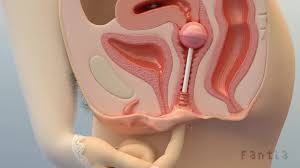 Bambina Inachin 3D observation diary - HD pornhex