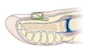 Cpu Chapter 9 The Integumentary System Flashcards Quizlet