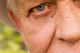Sep 25, 2012 · frownies are a great skin product and a cheap way of getting rid of wrinkles while you sleep. How To Remove Wrinkles In Photoshop Photoshop Essentials