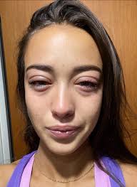 Yo al día siguiente después de d4rmelas de d3tective.