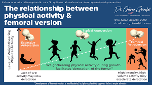 Image result for Femoral Retroversion