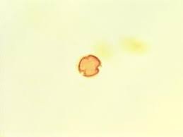 Image result for Cassipourea ndando