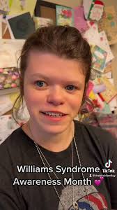 Alexandra Birch (@thealexandrabirch) • Facebook