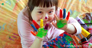 It occurs in 1 in every 792 live births. Down Syndrom Trisomie 21 Symptome Folgen Ursache Netdoktor