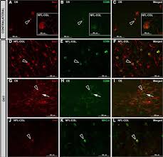We did not find results for: Microglia In Mouse Retina Contralateral To Experimental Glaucoma Exhibit Multiple Signs Of Activation In All Retinal Layers Springerlink