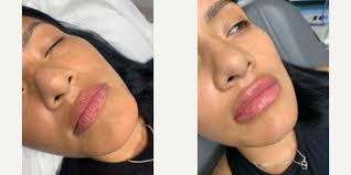 Wilson DuMornay, MD, FACS, Otolaryngologist